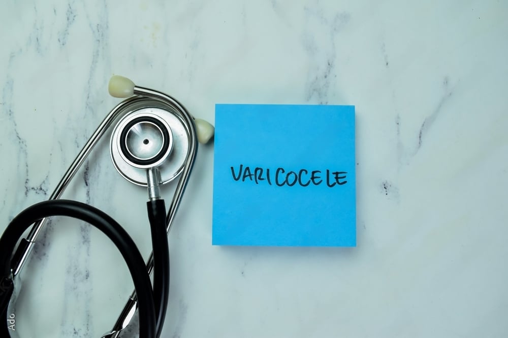 Varicocele conoce sus síntomas y tratamiento Dr Jeilan Martínez Hoed Urologo Costa Rica