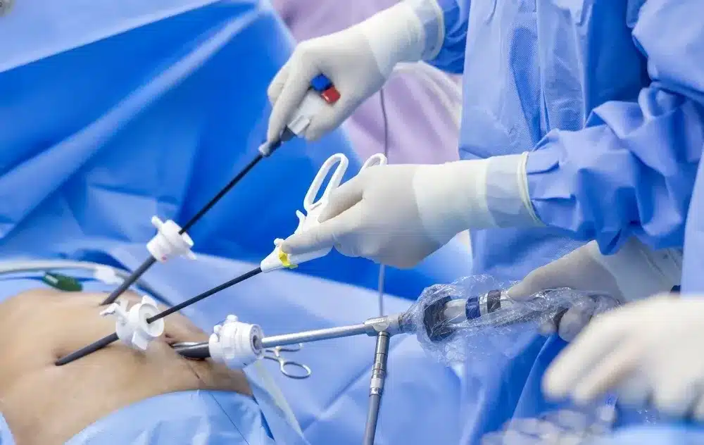 Cirugía con laparoscopia en San José Costa Rica: lo que necesita saber